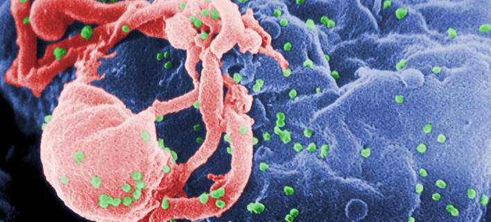 Επανάσταση κατά του AIDS: Νέα αντισώματα επιτίθενται στο 99% του ιού HIV